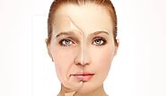 FACELIFT- Face & Neck Lift, Rhytidectomy - Dr Zenia Chow ENT Facial Plastic Surgeon Melbourne