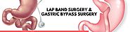 Lap Band Surgery in Puebla | A Listly List