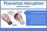 What is Placental Abruption? | Specialty Care Clinics