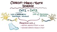 Charcot-Marie-Tooth Disease (CMT) - Symptoms, Causes, and Treatment