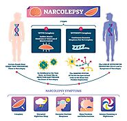 Narcolepsy: A Rare Neurological Disorder | Symptoms, Cause and Treatment