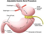 Home - Brisbane Obesity Clinic