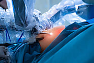 Bariatric Surgery Brisbane Guide - Dr Mikhail Mastakov