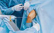 Total Knee Replacement | Sydney Knee Surgeon