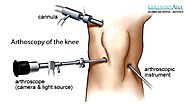 Total Knee Replacement - Sydney Knee Specialists