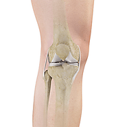 Total Knee Replacement Melbourne VIC | Knee Surgey Melbourne