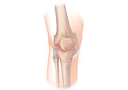 Robotic Knee Replacement Melbourne | Mr Soong Chua