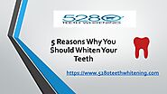 5 Reasons Why You Should Whiten Your Teeth