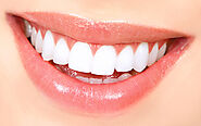 Advantages Of Teeth Whitening In Denver