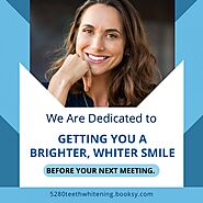 Mobile Teeth Whitening In Denver: The Convenience Of A Brighter Smile