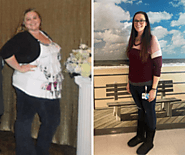 Center for Weight Loss Surgery - Jersey Shore University Medical Center