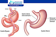 Duodenal Switch Bariatric Surgery