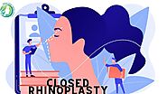 What is closed rhinoplasty? | A brief overview