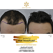 Hair Transplant Clinic in Dubai & Abu Dhabi | Most Advanced FUE Specialist