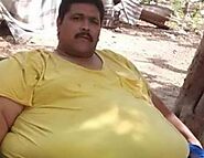 World’s most obese man dies after weight-loss surgery | World News - Hindustan Times