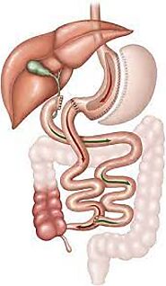 Sleeve Gastrectomy in Nogales, Mexico