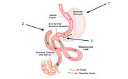 Dr. Fernando Garcia, WLS - Bariatric Mexico Surgery