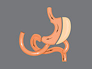 Duodenal Switch | AMITA Health | Chicago, IL