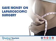 Save money on laparoscopic surgery in Toluca in 2021 | Medical tourism, Best doctors, Bariatric surgeon