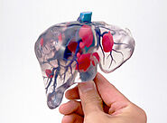Impresión 3D de órganos para planificación quirúrgica