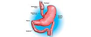 43845 Gastroplasty duodenal switch - Clear Health Costs