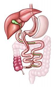 Duodenal Switch Surgery - Medical Tourism Resource Guide