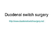 Duodenal Switch Surgery