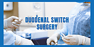 Duodenal Switch Surgery: Should You Get it Done? | CBSI