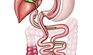 Duodenal Switch Surgery - Weight Loss Surgery Experts