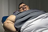 Philippines Report One time ‘world’s heaviest man’ has second surgery in Mexico - Philippines Report
