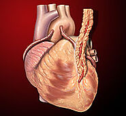 Coronary artery bypass surgery - Wikipedia