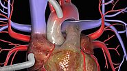 Conduits Used in Coronary Artery Bypass Grafting: A Review of Morphological Studies