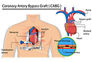 Who or Where in Durango, Co area? - Weight Loss Surgeons & Hospitals - BariatricPal