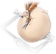 Prueba de Esfuerzo Matamoros | Cardiologo Matamoros