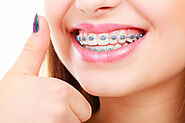 Teeth Braces in Gurgaon @9711811272 | Dental Braces Cost