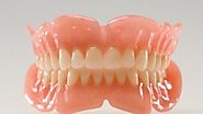 Alpharetta Dentist Dentures