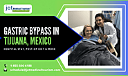 Gastric Bypass Mexico | Roux-en-Y Gastric Bypass (RNY) Tijuana | $5,499