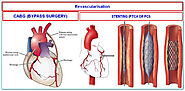 Hospitals, Latest Hospitals News, Health News - ET HealthWorld