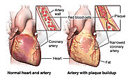 Bariatric Surgery Tijuana, Mexico - Monterrey, Mexico - Weight Loss Surgery - Tijuana Bariatrics, LLC