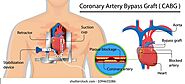 Gastroenterology Clinics in Mexico • Check Prices & Reviews