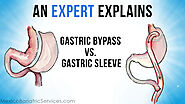 Gastric Bypass in Mexico | Packages from $5,195 to $6,495