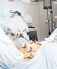 Gastric Sleeve Surgery in Zamora | A Listly List