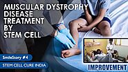 Muscular Dystrophy Disease Treatment in India - Stem Cell Cure India