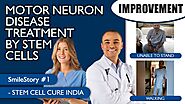 Motor Neuron Disease Treatment | Stem Cell Treatment for Motor Neuron Disease