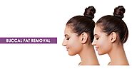 Guide To Buccal Fat Removal And The 4 Steps To Follow - TrendingFastIndia