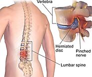 Back Pain Treatment | Sheikh Medical Care