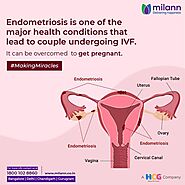 Endometriosis Treatments