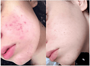 Skin Problems, and its Causes and Treatments You Must Know