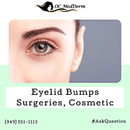 Eyelid bumps surgeries, Cosmetic Irvine & Orange County
