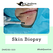Skin Biopsy Orange County | Dr. Parvin Shafa